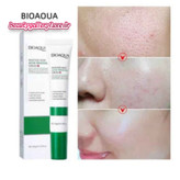 کرم ضد جوش فوری سالیسیلیک اسید