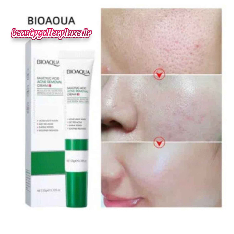 کرم ضد جوش فوری سالیسیلیک اسید