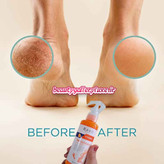 پک طلایی مراقبت از پا